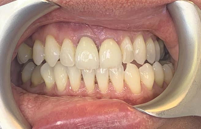 After - Quality Dental