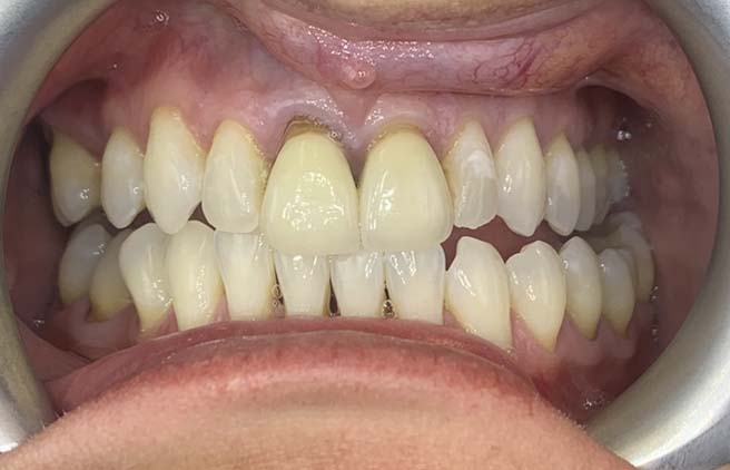 Before - Quality Dental