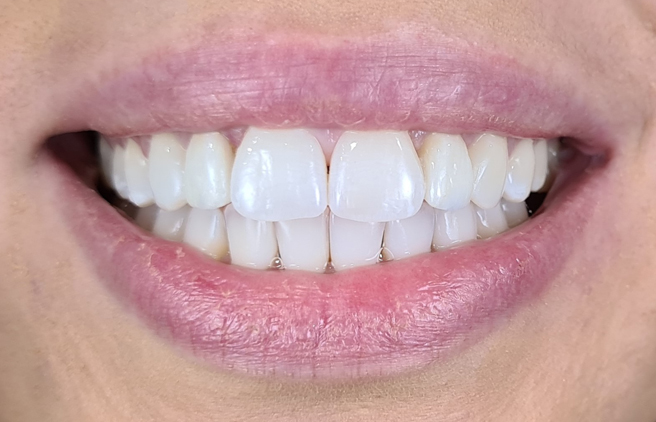 After - Quality Dental