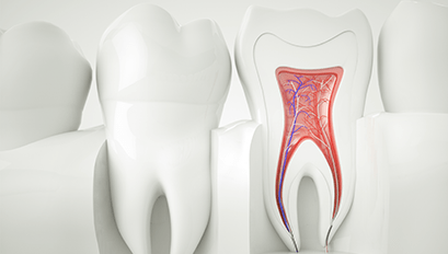 Treatment - Qualitydental