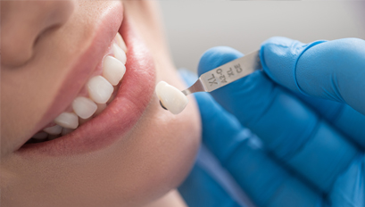 Treatment - Qualitydental