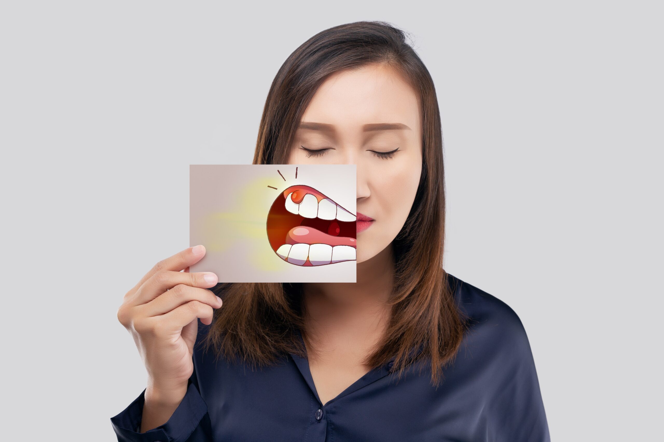 Asian woman in the dark blue shirt holding a paper with the periodontal and gingivitis cartoon picture of his mouth against the gray background, Decayed tooth, The concept with healthcare gums and teeth